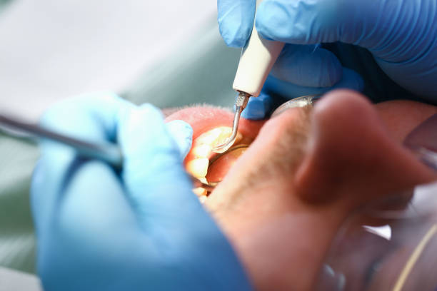 Best Emergency Dental Extractions in English Creek, NJ