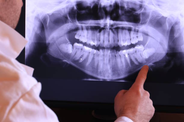 Best Emergency Dentist for Lost Fillings or Crowns in English Creek, NJ